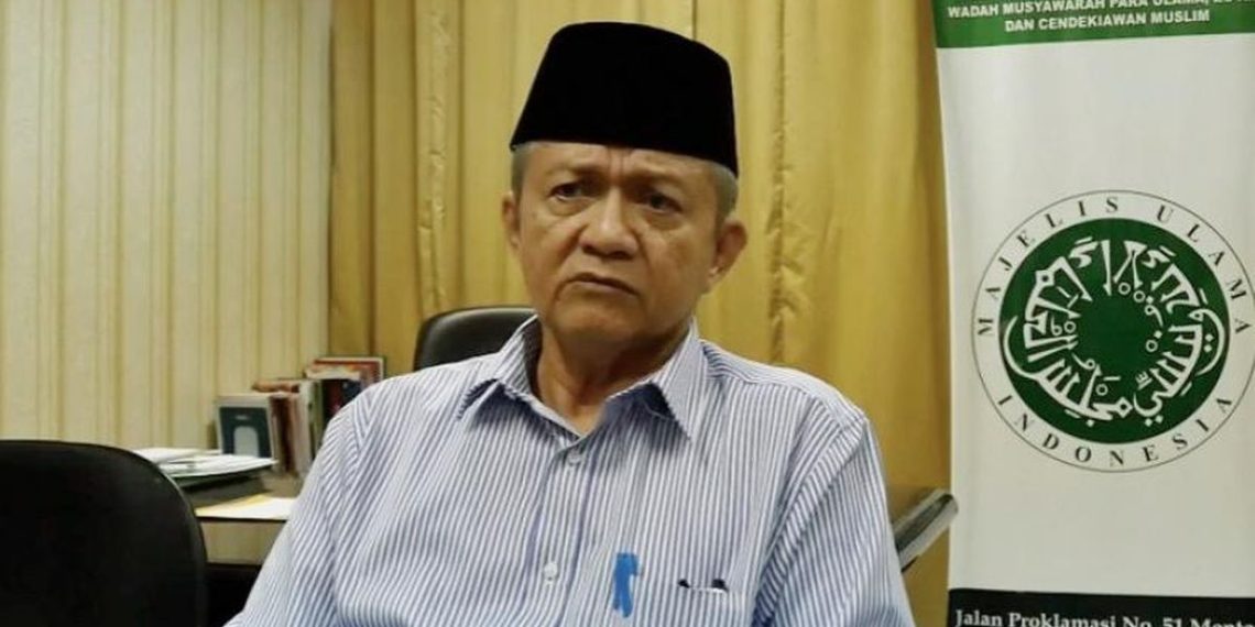 MUI Tegaskan Operasi Kelamin tak Ubah Status Gender Seseorang dalam Agama