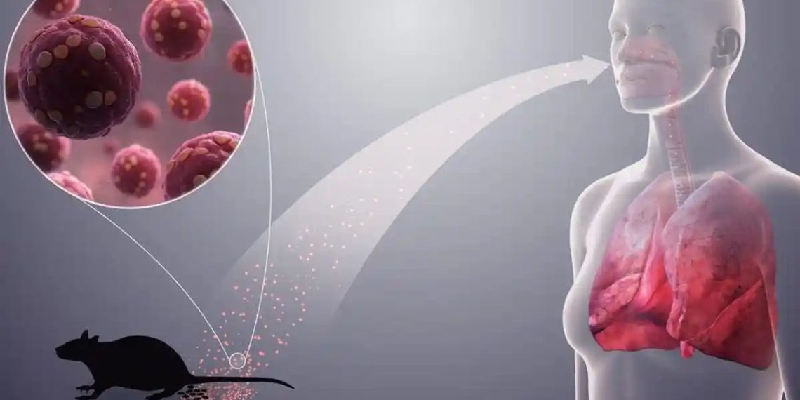 Jemaah Tak Perlu Panik! Saudi Pastikan Haji 2026 Aman dari Hantavirus,