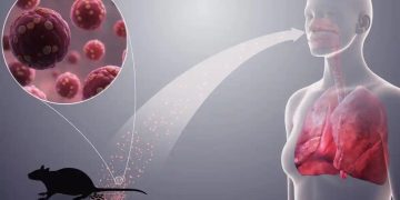 Jemaah Tak Perlu Panik! Saudi Pastikan Haji 2026 Aman dari Hantavirus,